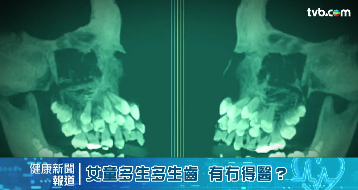 0081fd54-8ecd-464e-ada8-ca217dbe6772.png.webp
