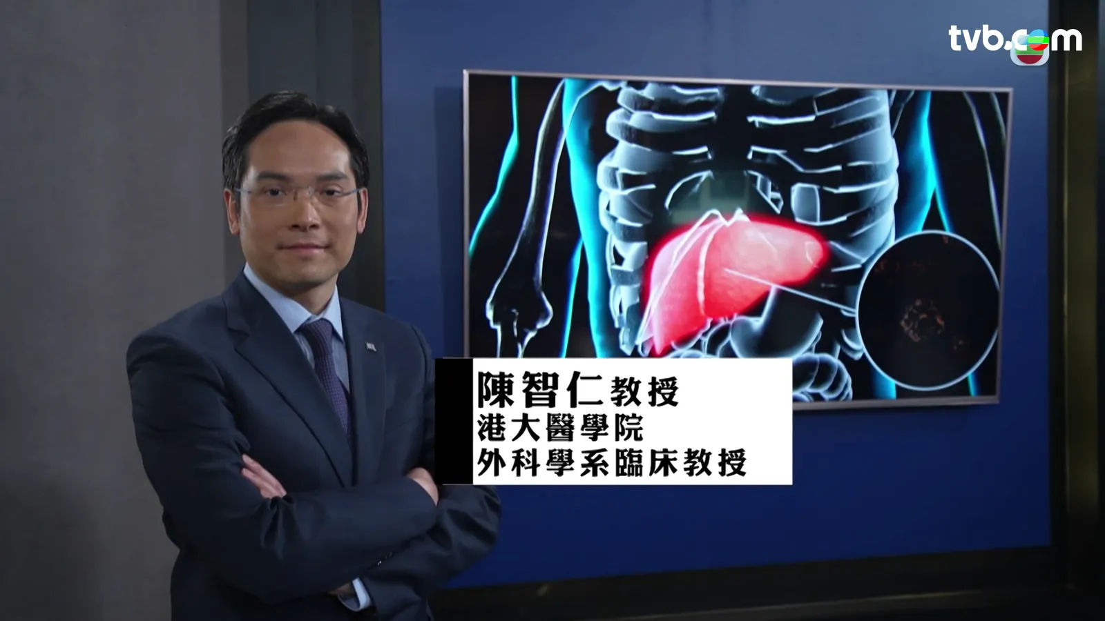 32b52bbd-e6ca-42a6-b3c5-2f4ae42fe9ad.png.webp