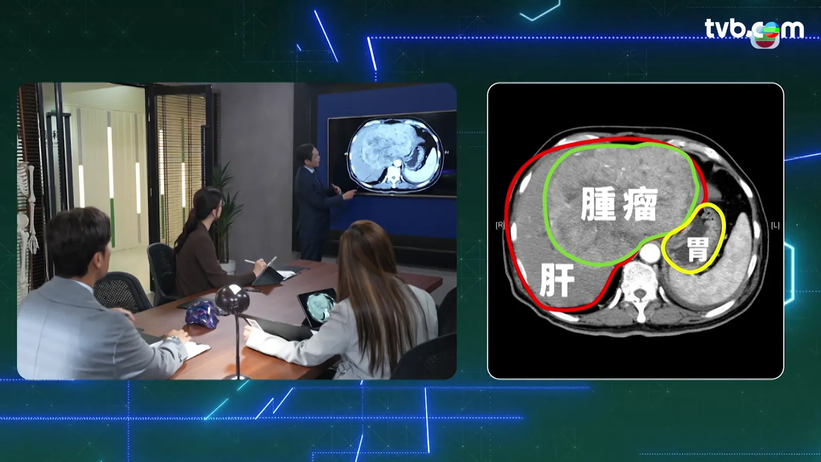 578fc5aa-609f-416b-a7ca-e0c734868473.png.webp