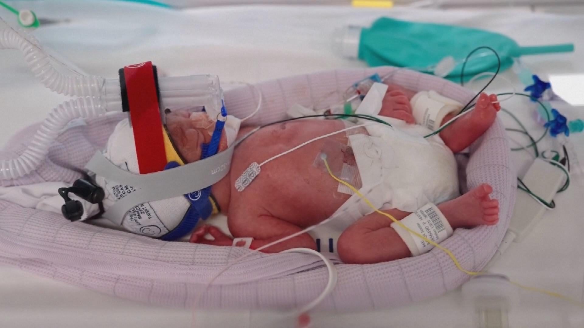 Picture_J.AUS.BIRTH-1700_001.jpg